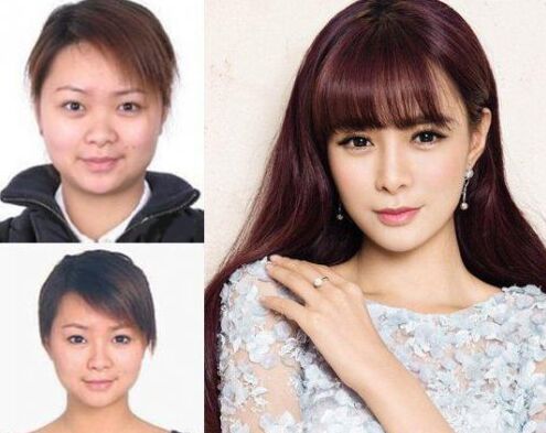 沈梦辰整容对比图 下巴塞的假体被发现 