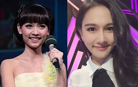 白富美孙骁骁整容前竟是土肥圆 孙骁骁整容对比图