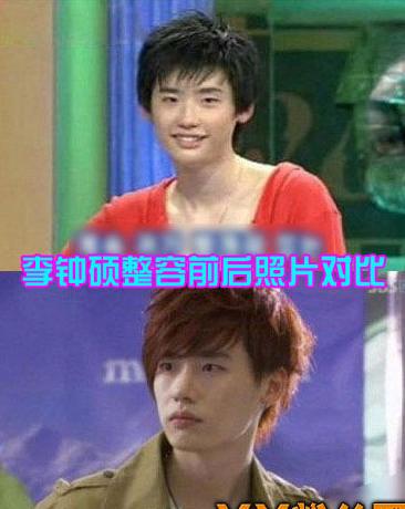 李钟硕整容前后照片对比 李钟硕究竟整了哪些地方