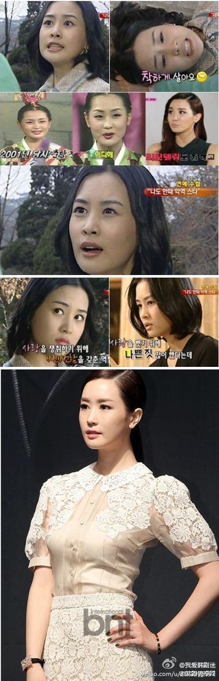 韩国女星李多海大方承认整容