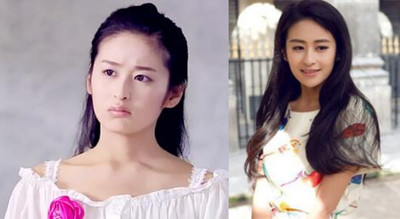 颖儿疑因整容失败导致嘴部歪斜