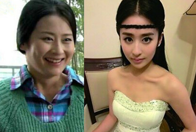 颖儿疑因整容失败导致嘴部歪斜