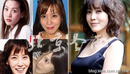 20位女星整容前后对比照：允儿整容前似李宇春