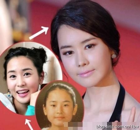 20位女星整容前后对比照：允儿整容前似李宇春