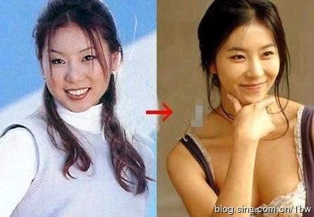 20位女星整容前后对比照：允儿整容前似李宇春