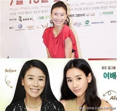 20位女星整容前后对比照：允儿整容前似李宇春
