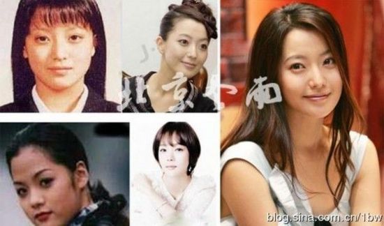 20位女星整容前后对比照：允儿整容前似李宇春