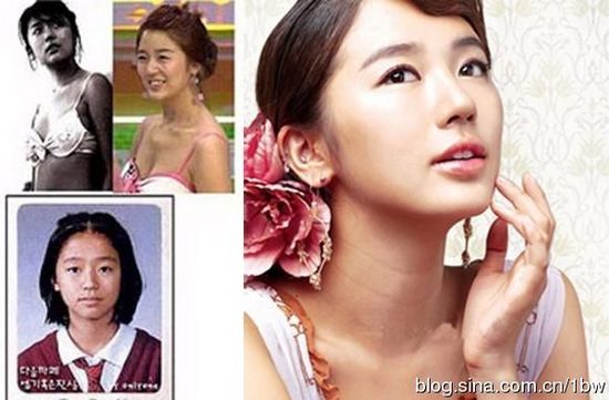 20位女星整容前后对比照：允儿整容前似李宇春