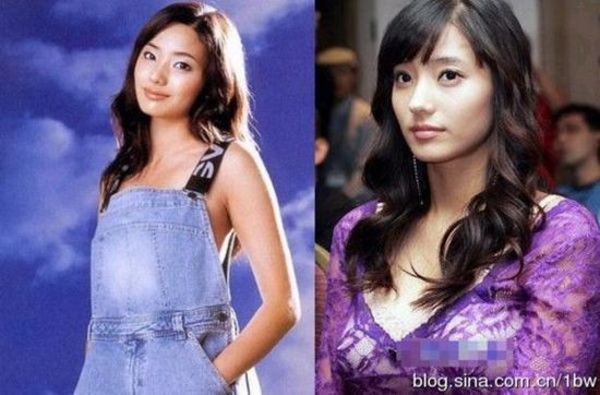 20位女星整容前后对比照：允儿整容前似李宇春