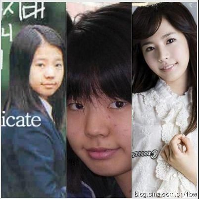 20位女星整容前后对比照：允儿整容前似李宇春