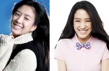 20位女星整容前后对比照：允儿整容前似李宇春