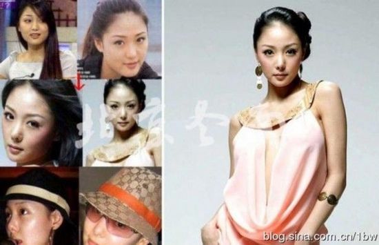 20位女星整容前后对比照：允儿整容前似李宇春