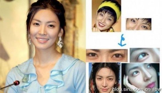 20位女星整容前后对比照：允儿整容前似李宇春