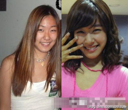 20位女星整容前后对比照：允儿整容前似李宇春