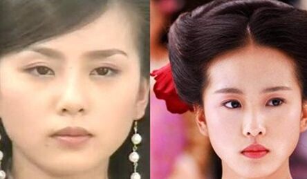 刘诗诗大饼脸变鹅蛋脸 刘诗诗整容对比图