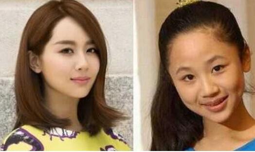 杨紫整容前后照片对比 杨紫承认整容了吗