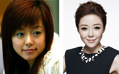 超女冠.军安又琪变成了整容怪? 安又琪整容对比图