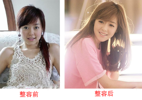 超女冠.军安又琪变成了整容怪? 安又琪整容对比图