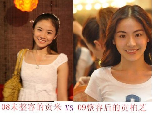 贡米整容前后对比照
