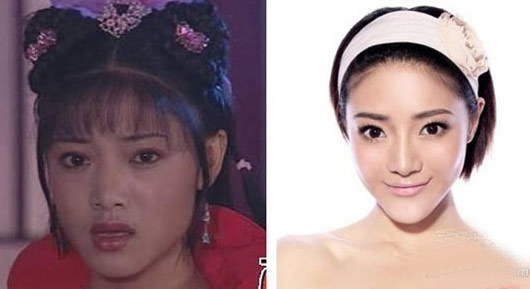 邓家佳整容前后对比