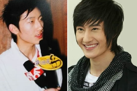 周觅被怀疑整容