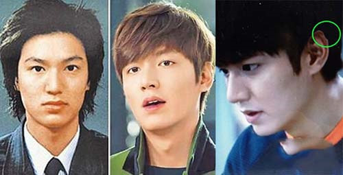 特别曝光李敏镐整容前后对比照片