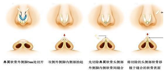 杭州华山整形医院价目表价格表抢先一览