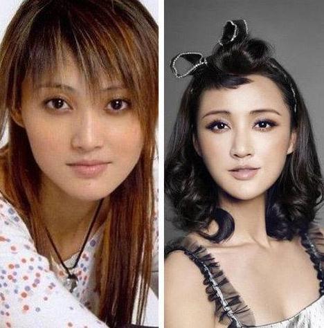 张歆艺整容前后照片对比被挖出 网友惊呼认不出.jpg