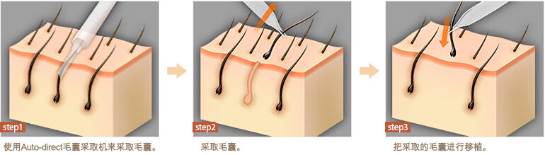 北京美联臣整形医院价目表全新曝光一览