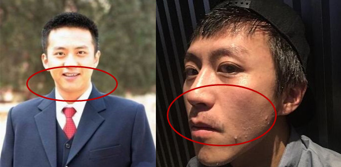 邓超整容前后对比照