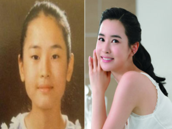 韩星李多海爽快承认整容 李多海整容前后照片对比震惊网友