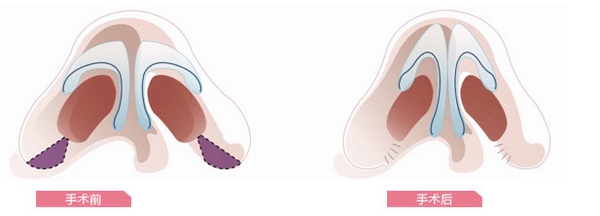 深圳阳光整形美容医院价格表真实曝光