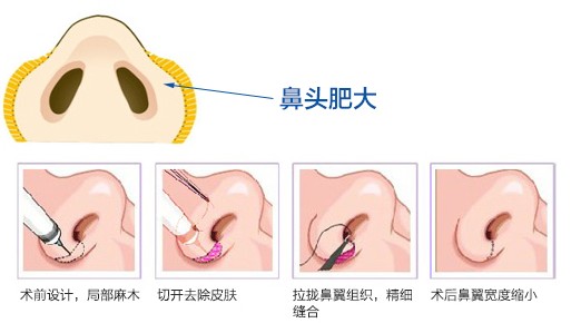 上海华美医疗美容医院2017价格表新预览