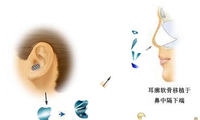 天津欧菲整容医院2017全新版价格表揭秘