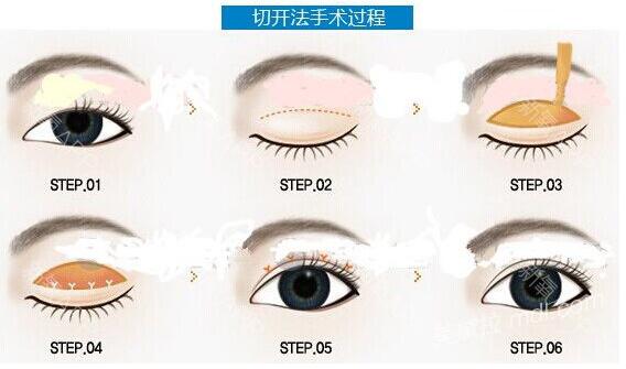 重庆美伽整形医院价格表全新抄底价