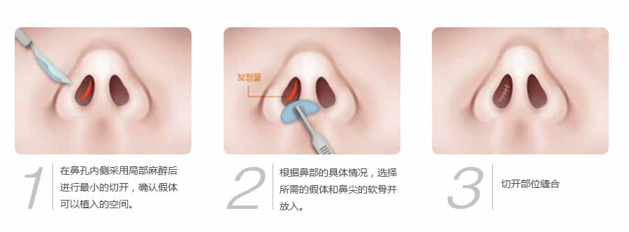 曙光整形医院价格表全新抄底价