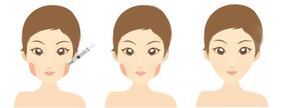 长春西之米整形医院新价格表抢先看