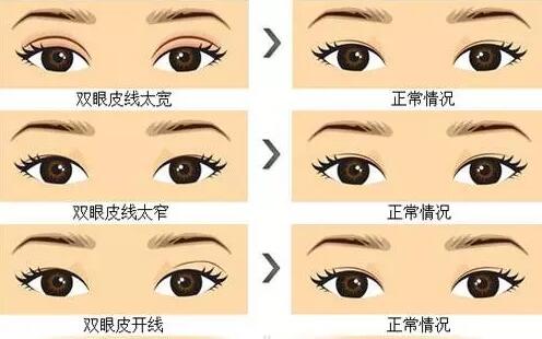 盘锦京韩整形医院价格表网红参考价