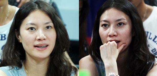 谢杏芳整容前后照片 整容后真的漂亮很多