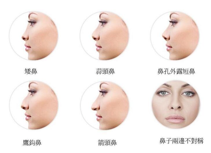 南京美立方整形医院全新参考价格表