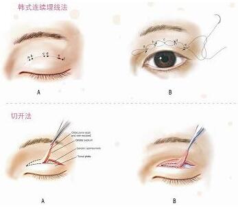 无锡春天整形美容医院新版价格表抢鲜