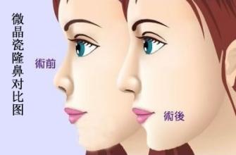南昌佳美整形医院价格表一览爆出