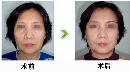 上海万丽医疗美容门诊**价格表曝光