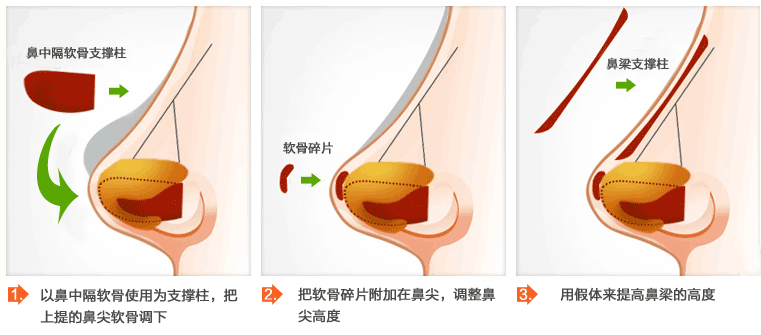 上海丽质整形医院价格表一览曝光