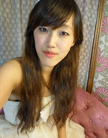 在北京艺星医疗美容医院做下颌角整形手术真实经历