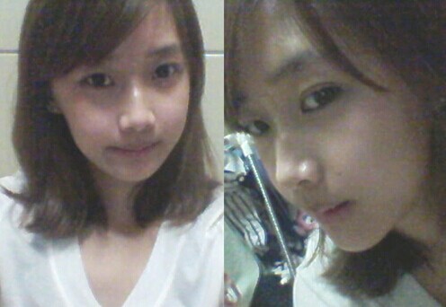 在北京艺星医疗美容医院做下颌角整形手术真实经历