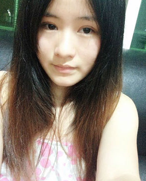 全切双眼皮十天啦~来看看我的果