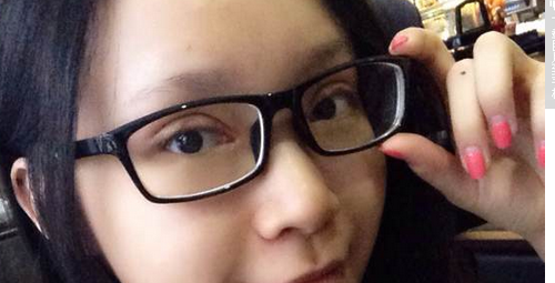 全切双眼皮+去皮去脂+开眼角一个月了~