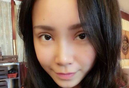 全切双眼皮+去皮去脂+开眼角一个月了~