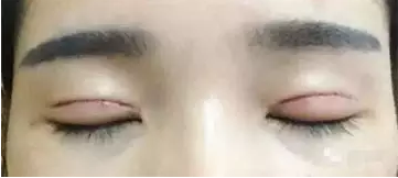 你离女神就差一个双眼皮~